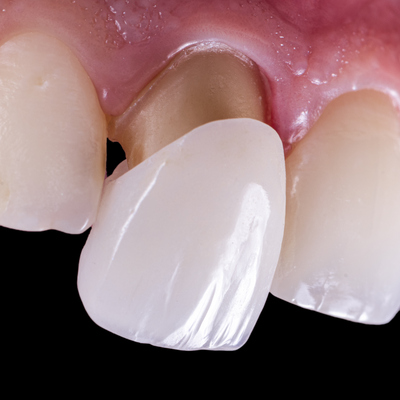 Dental work in the USA