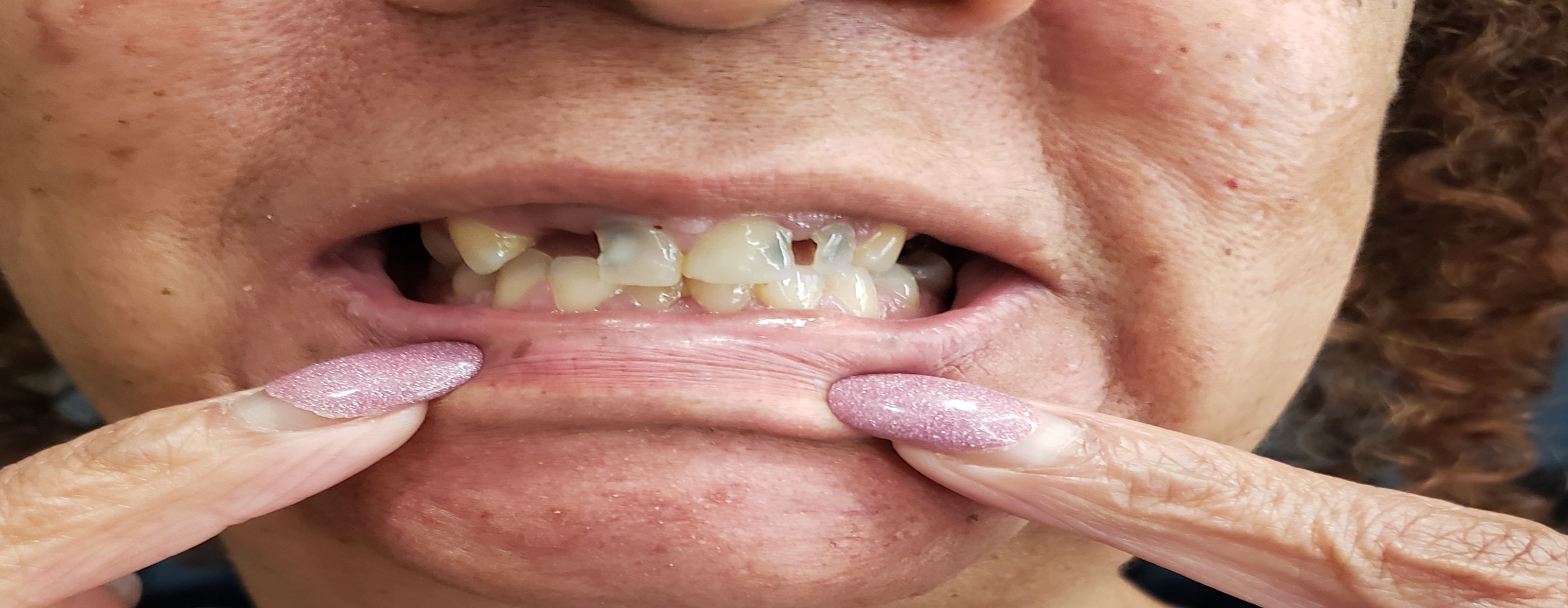 mouth closed