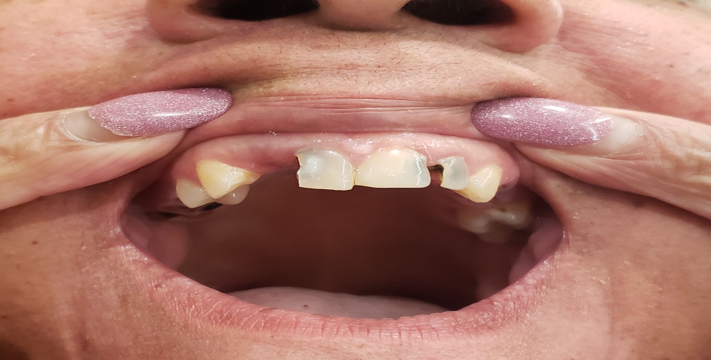 mouth upper arch
