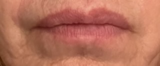 mouth closed