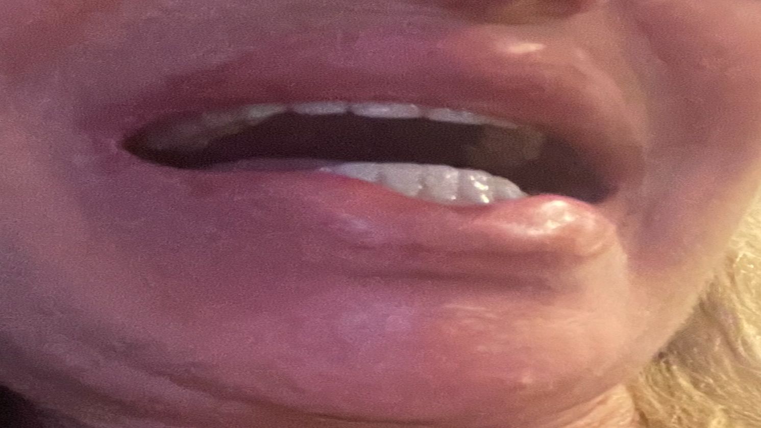 mouth right side