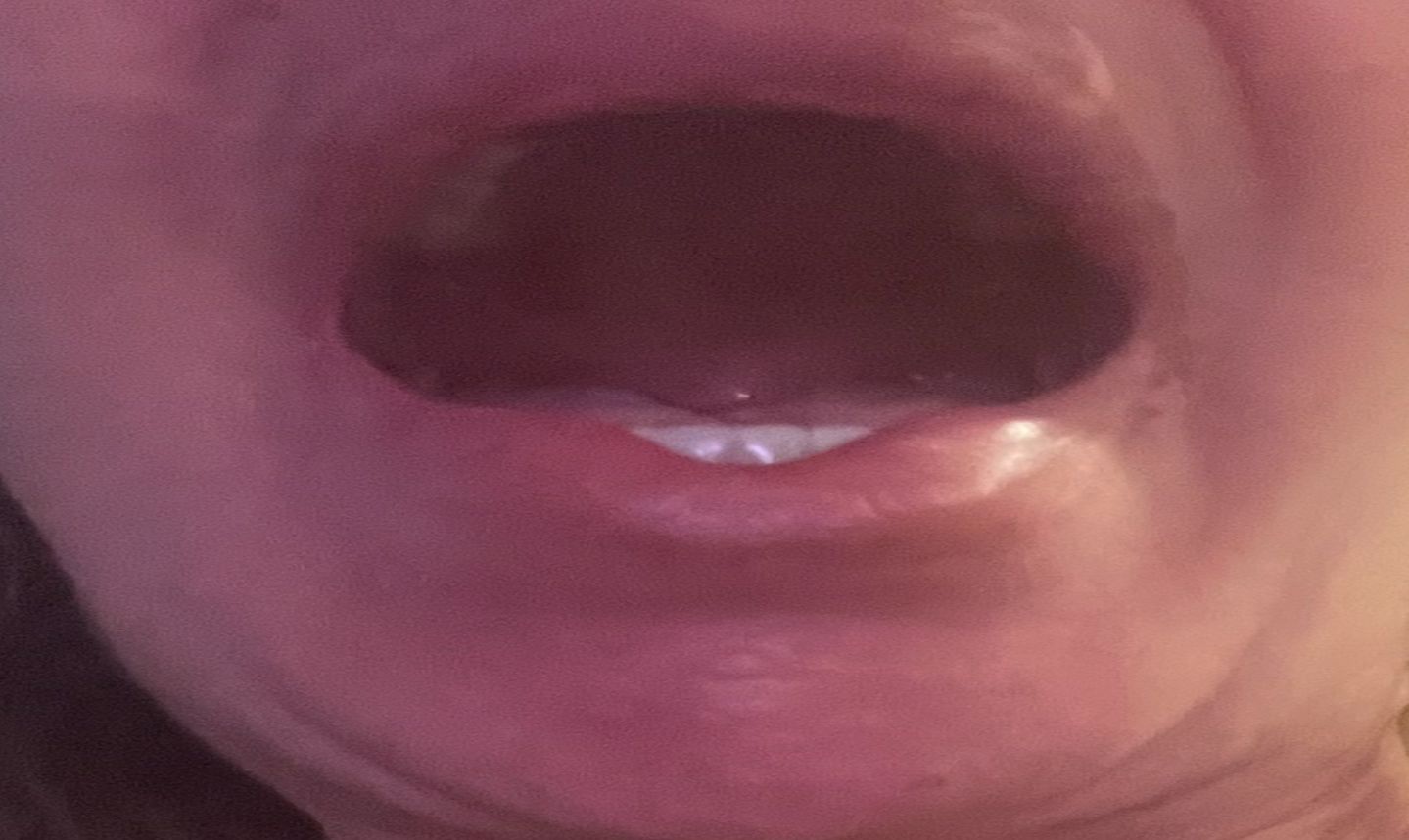 mouth upper arch