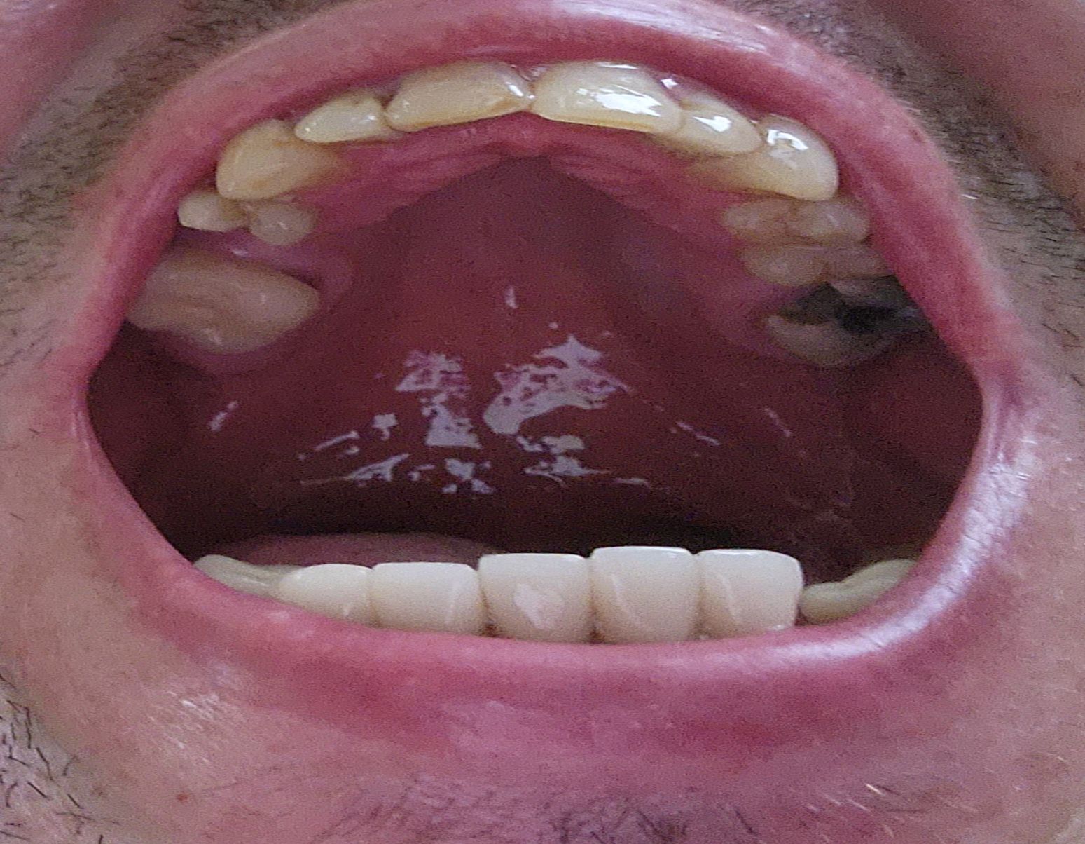 mouth upper arch