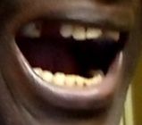 mouth closed