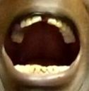 mouth open