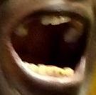 mouth left side
