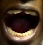 mouth lower arch