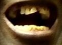 mouth more1