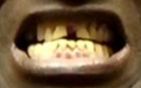 mouth more2