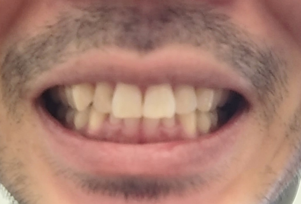 mouth closed