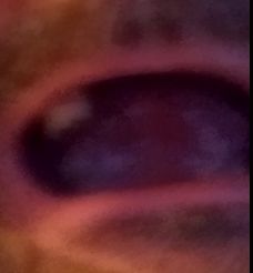 mouth upper arch