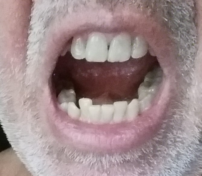mouth lower arch