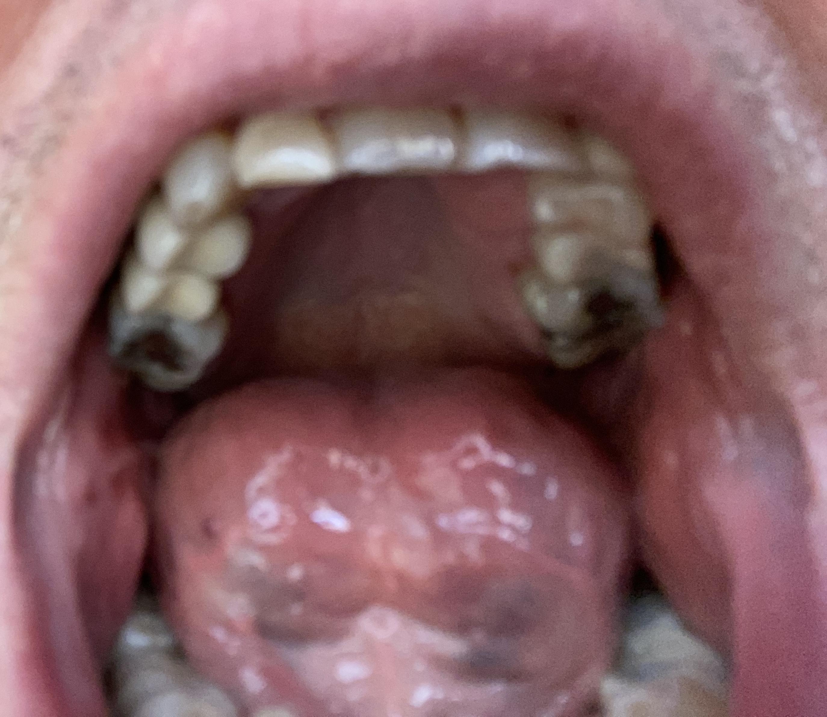 mouth upper arch