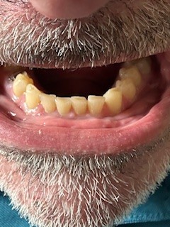 mouth lower arch