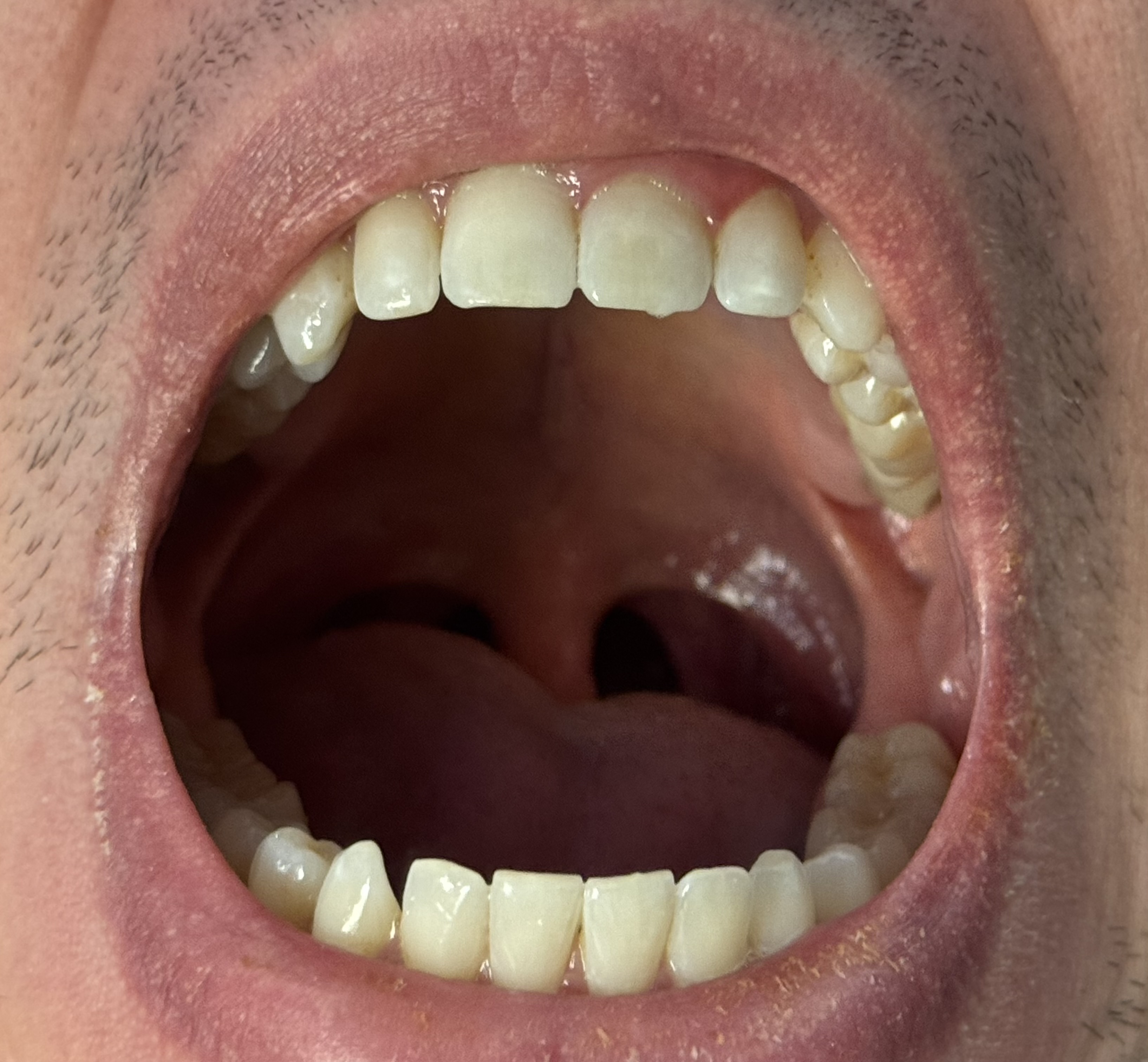 mouth open