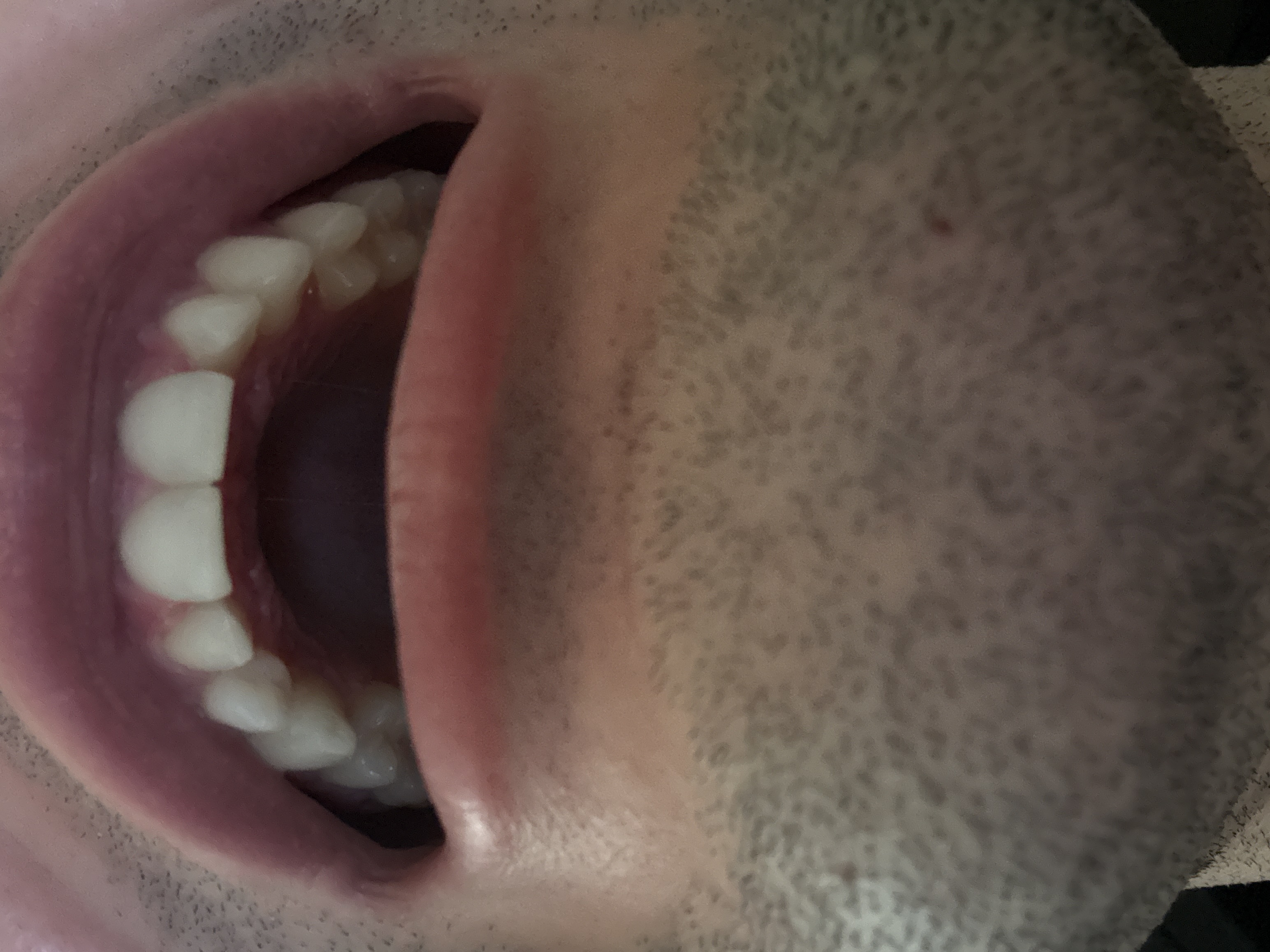 mouth upper arch