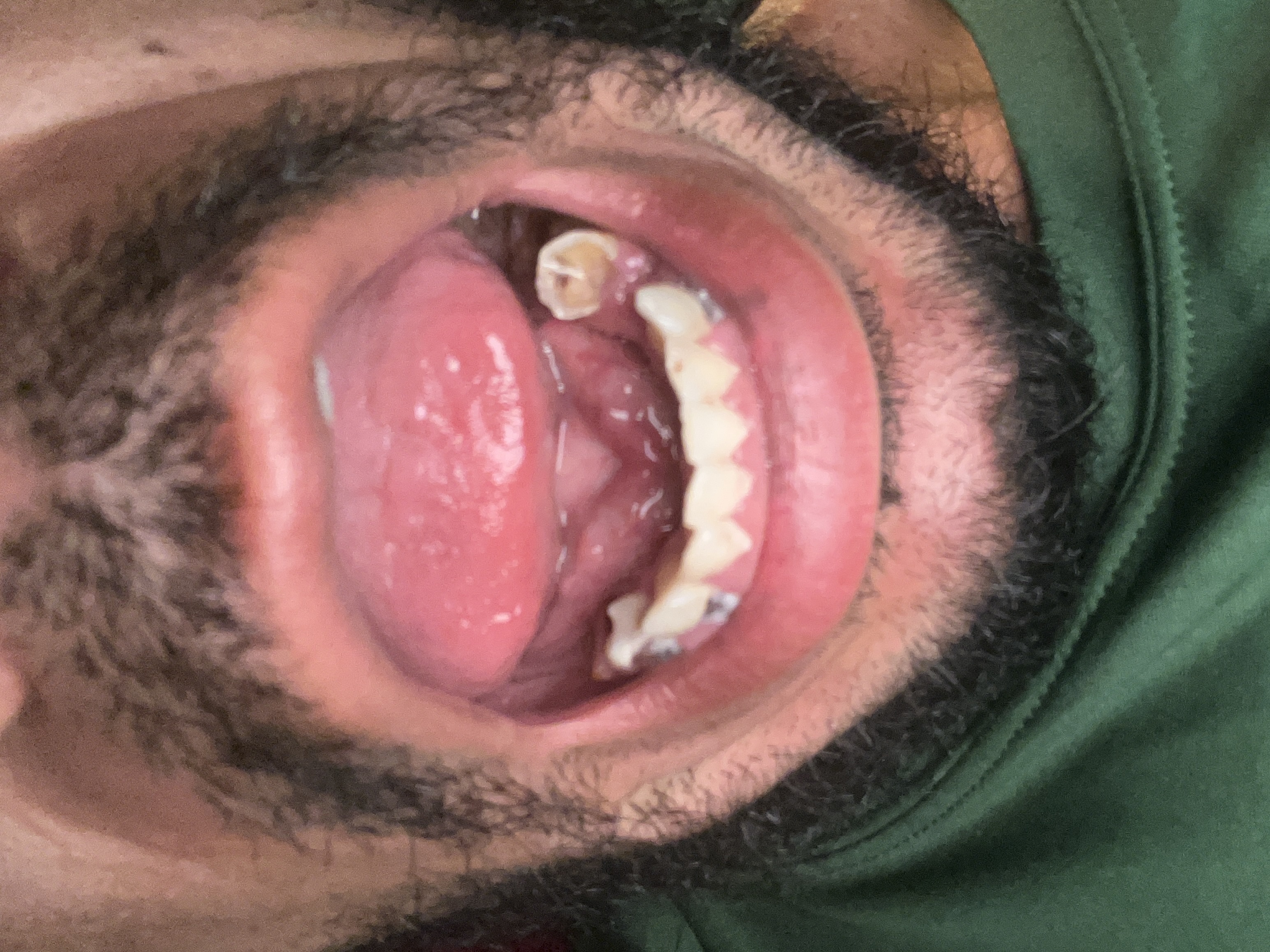 mouth lower arch