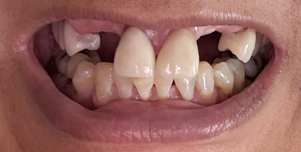 mouth closed