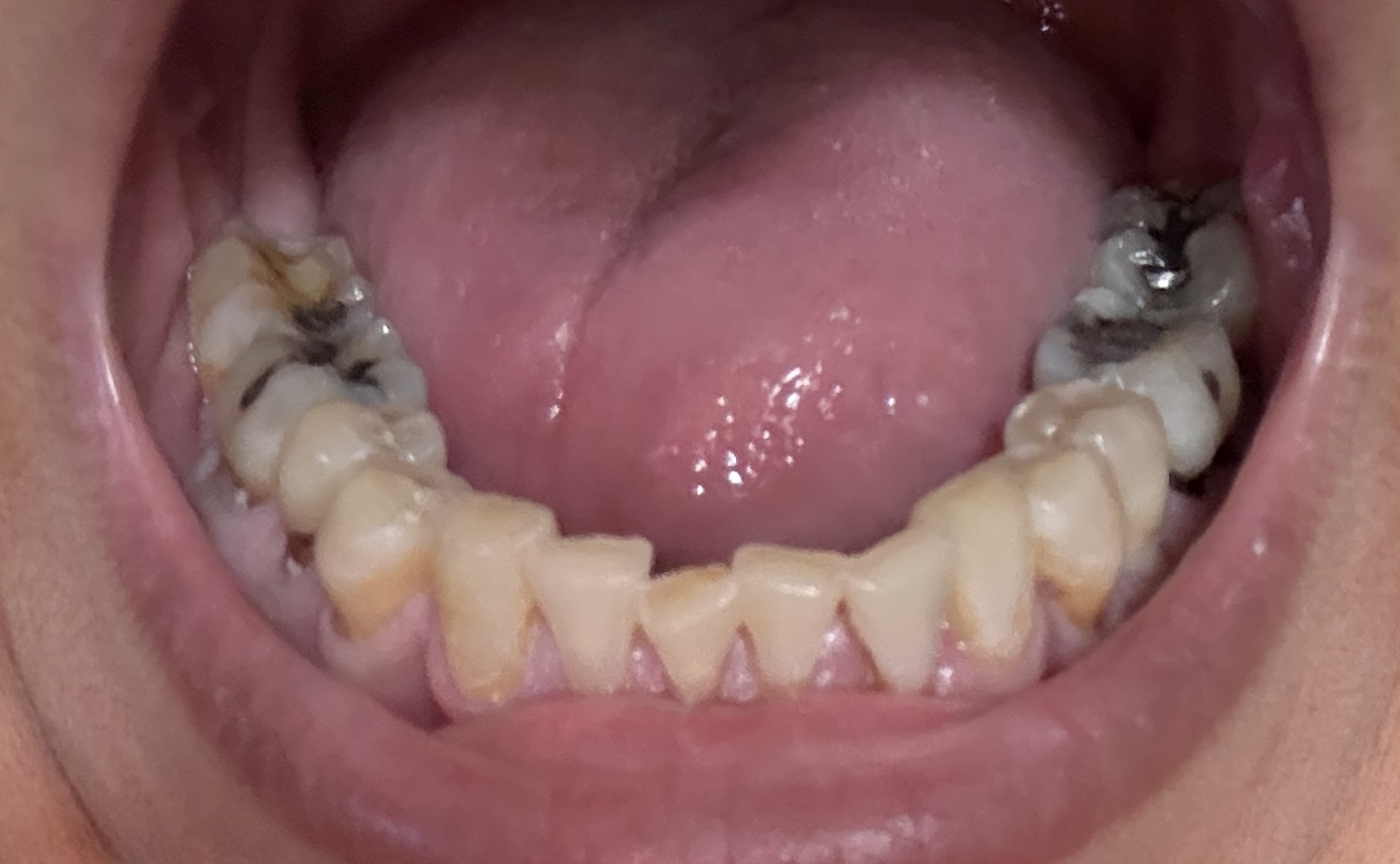 mouth lower arch