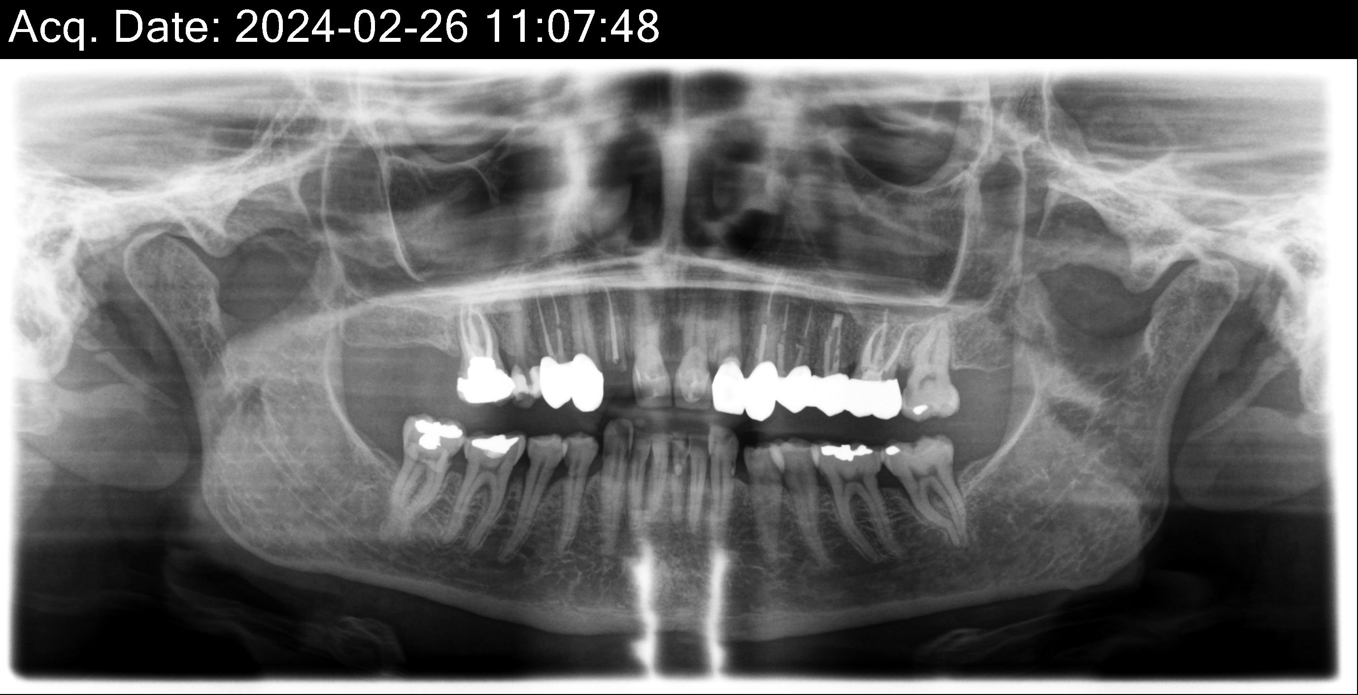 x-ray